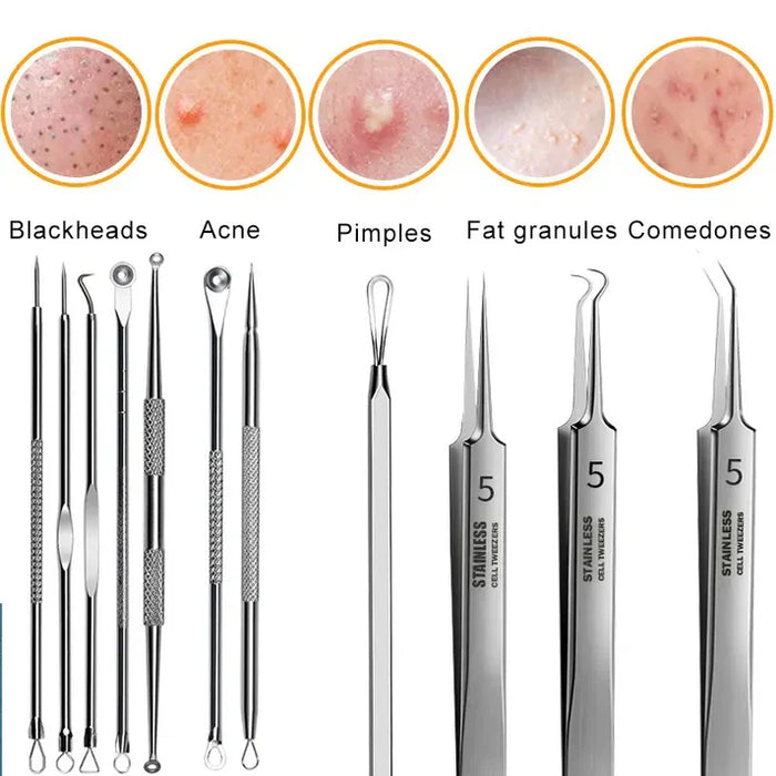 Acne Blackhead Removal Tool