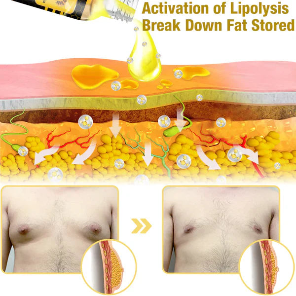 Huile chauffante pour gynécomastie au venin d'abeille GFOUK™ MenTherm