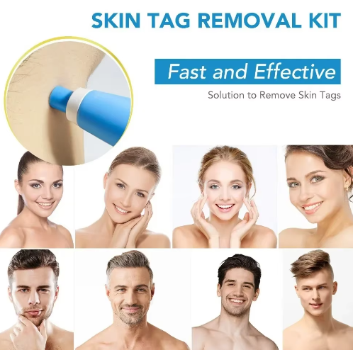 2-in-1 Painless Skin Tag, Mole, and Wart Removal Kit